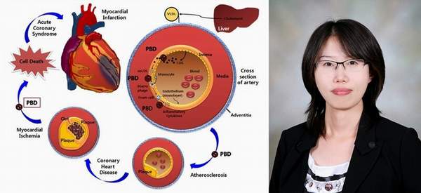 한미정 교수, 곡류, 과일 식단 심장병 예방 세계 최초 확인